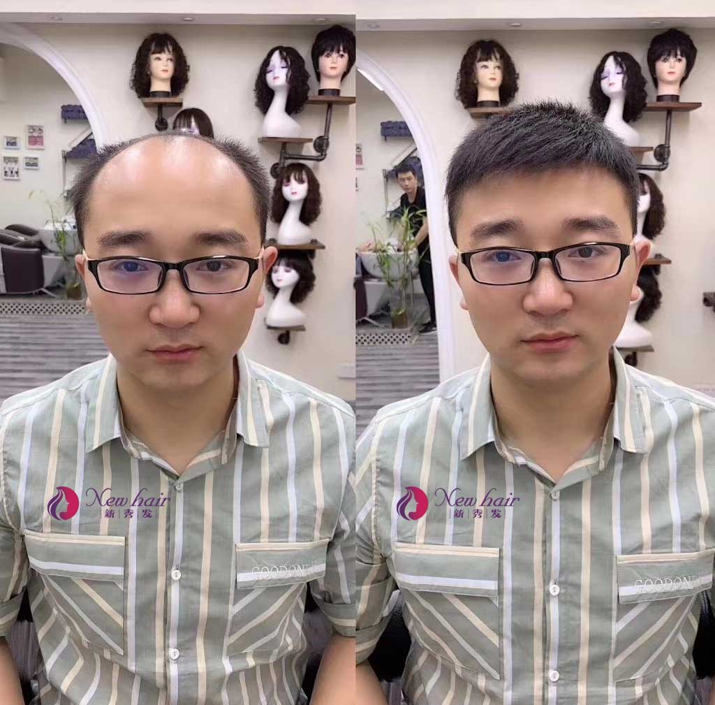 很多網(wǎng)友問我，為什么現(xiàn)在那么多人喜歡帶真發(fā)做的假發(fā)？