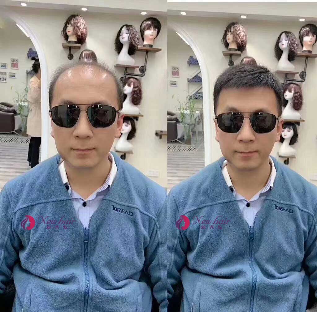 老年男士假發(fā)佩戴效果怎么樣？有沒有副作用？
