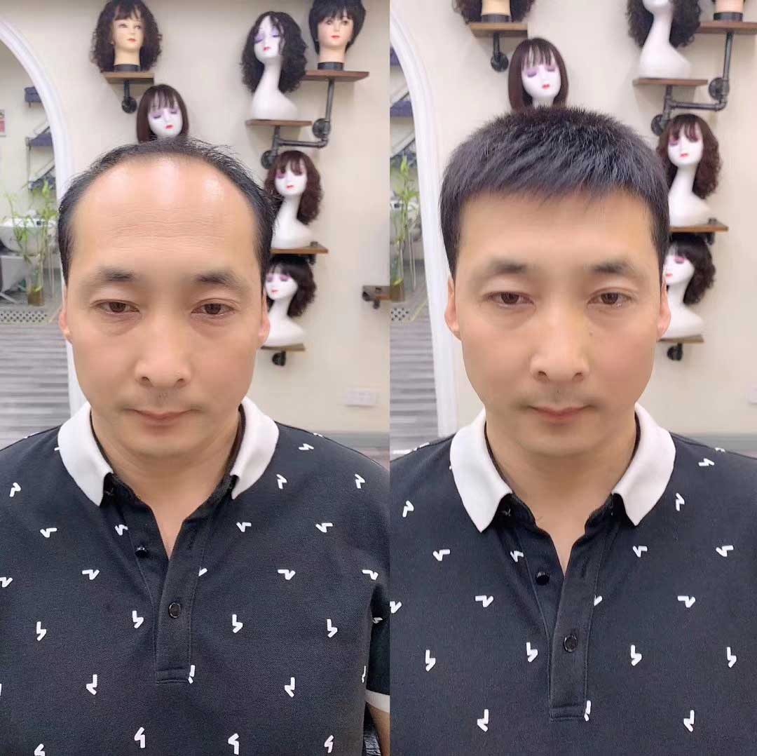 在青島這是脫發(fā)朋友真正需要的假發(fā)片！