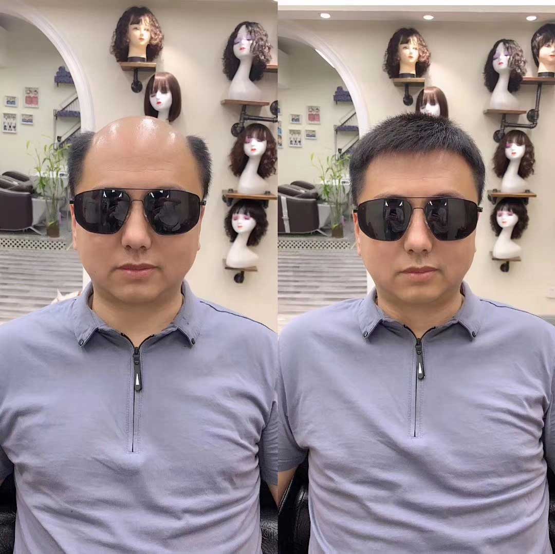 徹底解決掉發(fā)問題，這才是我要的！