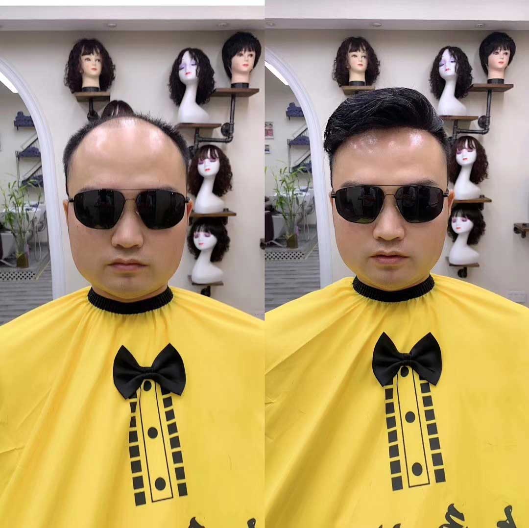 拯救禿頭造型，新秀發(fā)假發(fā)片立刻還你年輕自信人生！