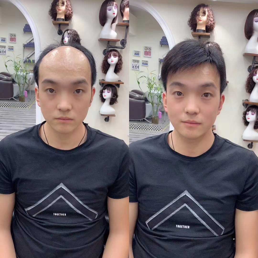 男人就該注重自己的形象，大叔通過假發(fā)片恢復(fù)發(fā)量變小鮮肉。
