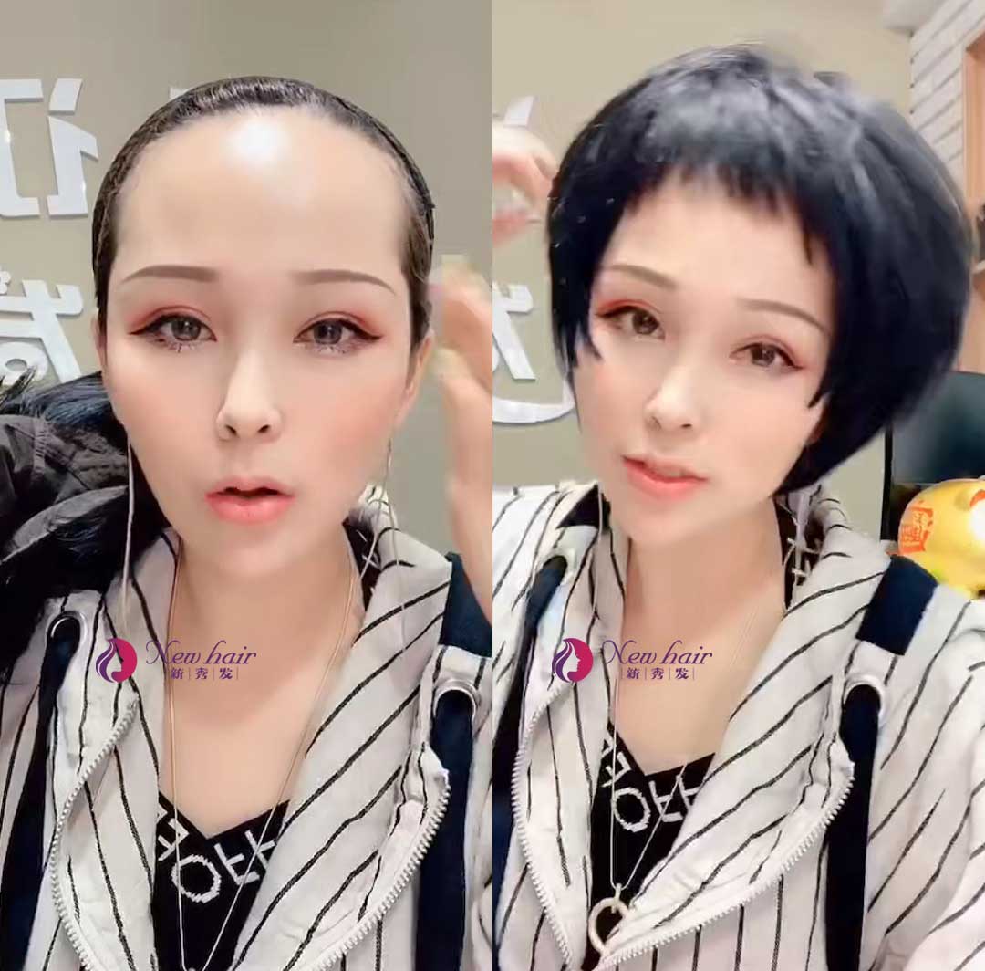 怎么佩戴假發(fā)？假發(fā)套價格怎么計算？